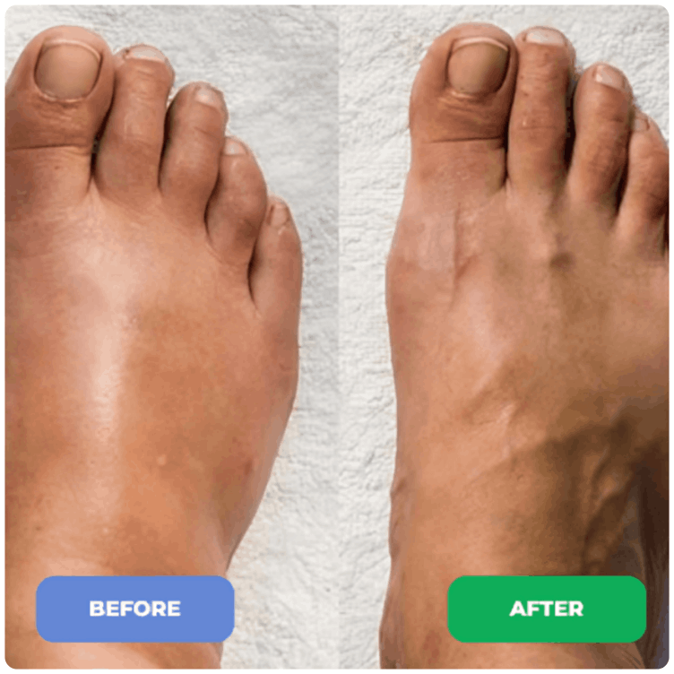 Ryoku EMS Foot Massage